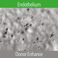 Konan CellChek D+. Imagen detallada de la Superficie Endotelial: Partículas de sangre I desechos I bacterias I hongos I cicatrices
