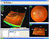 Topcon 3D OCT-2000, Tomógrafo de coherencia óptica