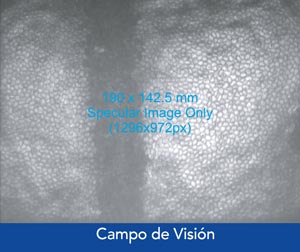Campo de visión del CellChek D de Konan, microscopio especular de imagen para banco de ojos